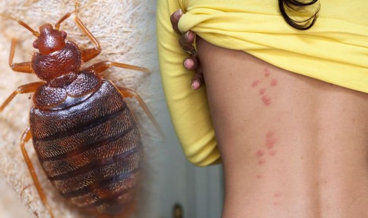 Bed bug bites: How to avoid them and get rid of an ...